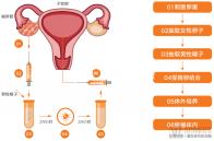 “大姨媽”來(lái)了,非得做陰道B超嗎?