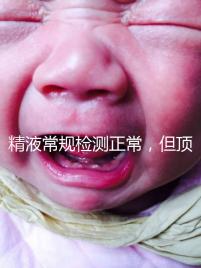 精液常規檢測正常,但頂體酶低,是否影響試管嬰兒成功率?