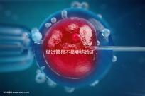 做試管是不是要結婚證，做試管需要結婚證