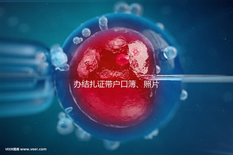 辦結扎證帶戶口簿、照片作用不大，要一樣就足夠~