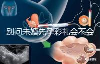 別問未婚先孕彩禮會不會少了，一分不給也不無可能