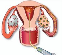 別還不造內(nèi)膜10mm鮮胚容不容易著床,能否移植看這幾點(diǎn)
