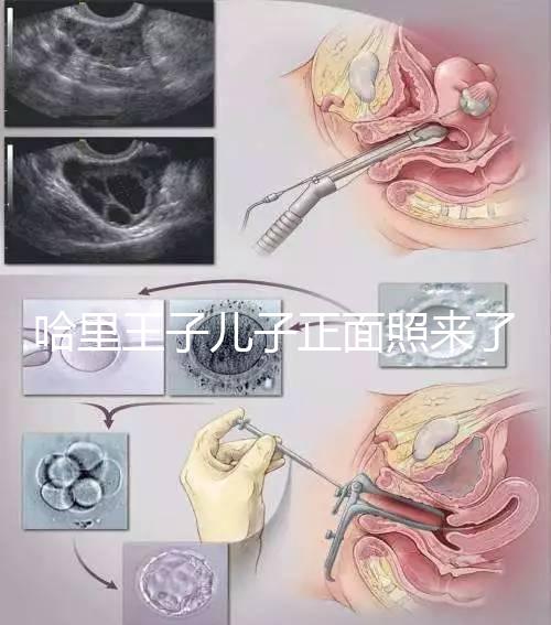 哈里王子兒子正面照來了，梅根評(píng)價(jià)：氣質(zhì)甜美，乖巧