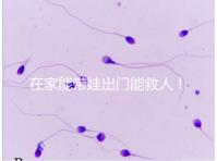 在家能帶娃出門能救人!張?jiān)迄i醫(yī)生為救人將孩子塞路人