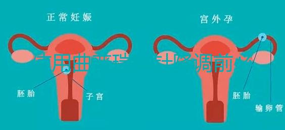 使用曲普瑞林針降調(diào)前必看：3大作用對比5大副作用