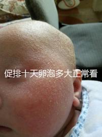 促排十天卵泡多大正?？催@，1.1×0.9符不符合一文說(shuō)清