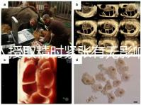 人授取精時(shí)緊張有無(wú)影響別還不造,注意事項(xiàng)不少不可不知