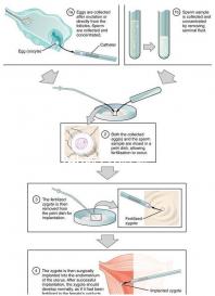 事后24h或72h吃避孕藥有效率真不高，一不小心容易中招
