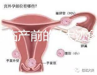 二胎臨產(chǎn)前的7大跡象，出現(xiàn)見紅、陣痛別大意
