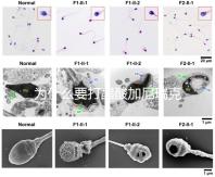 為什么要打醋酸加尼瑞克?試管拮抗劑方案的“穩定劑”