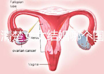 不清楚女女結(jié)婚哪個(gè)國(guó)家能領(lǐng)證來(lái)看，歐洲這些地區(qū)都可