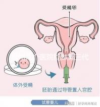 柳州幾個醫(yī)院能做第三代試管嬰兒?詳細的費用成功率都在這
