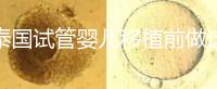 泰國(guó)試管嬰兒移植前做這3件事能提高成功率,不然會(huì)后悔!