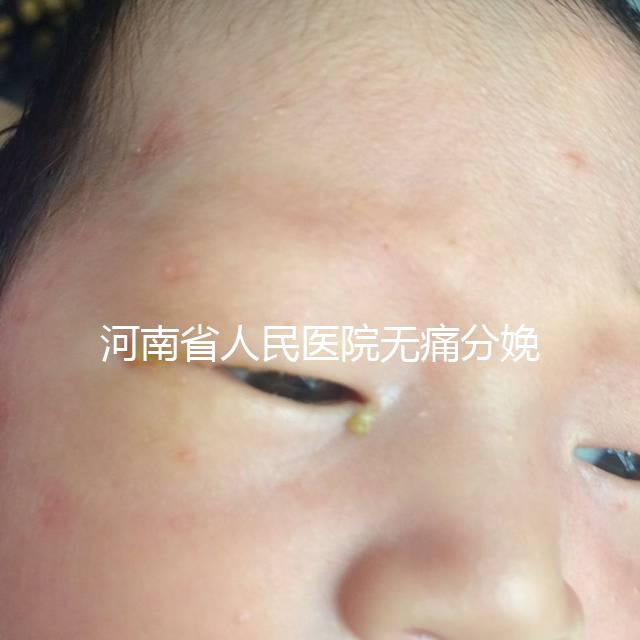 河南省人民醫院無痛分娩多少錢戳，收費標準60s看懂不踩坑