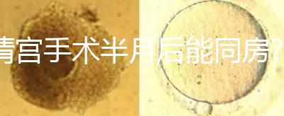 清宮手術(shù)半月后能同房?別盲目相信,聽醫(yī)生咋說!