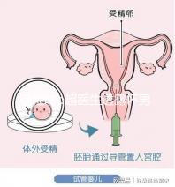 孕檢時(shí)b超醫(yī)生透露懷男寶女寶暗語(yǔ)寶典，一語(yǔ)戳中有心人！