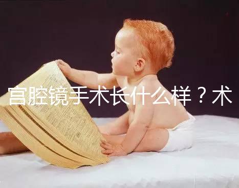 宮腔鏡手術(shù)長(zhǎng)什么樣?術(shù)后要注意什么? ?