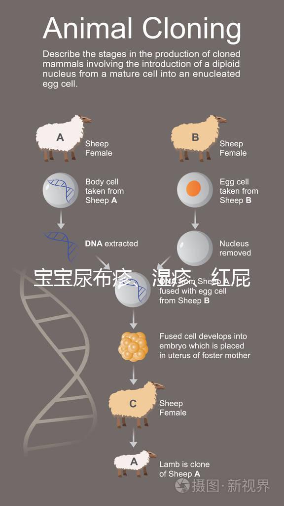 寶寶尿布疹、濕疹、紅屁股傻傻分不清?4點區(qū)別輕松診斷