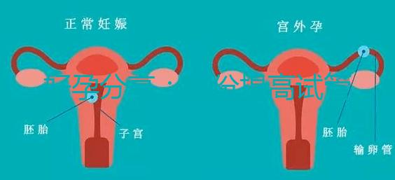 好孕分享：這份提高試管移植著床率的偏方快收藏！全是干貨