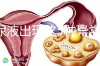 當(dāng)尿液出現(xiàn)這5種異常情況，那么腎功能檢查刻不容緩