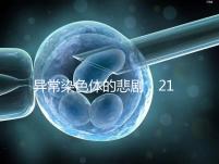 異常染色體的悲劇:21號(hào)三體,帶你走進(jìn)“唐寶寶”的世界