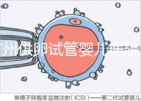 廣州供卵試管嬰兒醫院匯總，真實案例告訴你廣東哪家最好