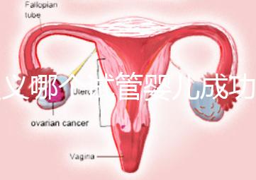 遵義哪個試管嬰兒成功率高？貴州生殖中心醫院2024年排名參考