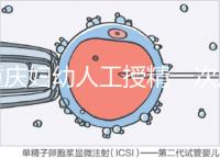 重慶婦幼人工授精一次成功率揭秘，移植費用貴有原因
