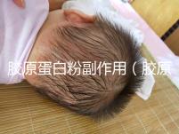 膠原蛋白粉副作用（膠原蛋白粉副作用和危害）