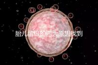 胎兒留級(jí)的四大原因找到了!多半和媽媽太懶不運(yùn)動(dòng)有關(guān)系