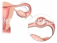 蘇州第三代助孕機(jī)構(gòu)正規(guī)可靠嗎？實(shí)地考察才為真