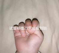 試管移植29天能看到胎心嗎？B超還能看孕囊大小和胎心