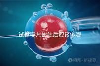 試管嬰兒出生后應該做哪些檢查答案？DR應該看情況嗎？