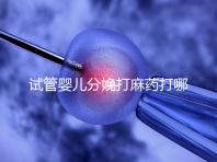 試管嬰兒分娩打麻藥打哪里看過來,疼不疼產(chǎn)科醫(yī)生告訴你