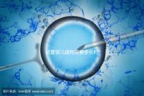 試管嬰兒建檔需要多長時間進(jìn)來瞧,內(nèi)含詳細(xì)流程供參考