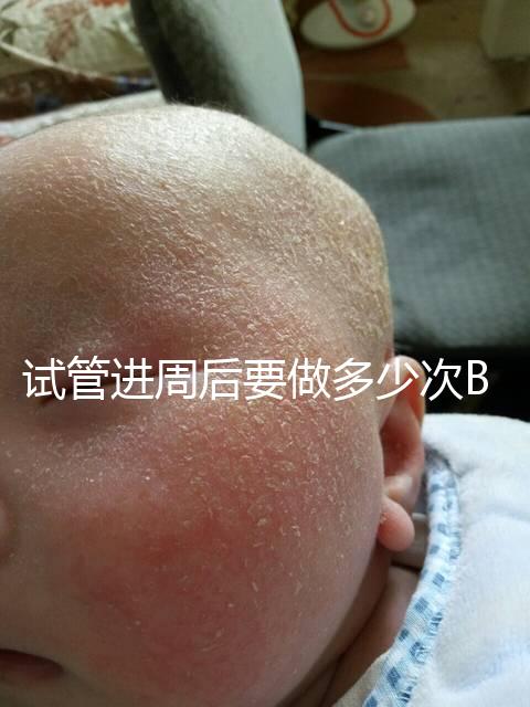 試管進(jìn)周后要做多少次B超？需要檢查什么？進(jìn)來看看