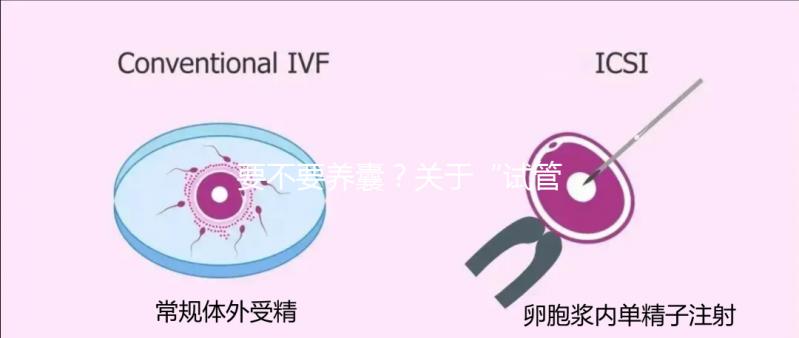 要不要養(yǎng)囊?關于“試管養(yǎng)囊”你是否會有很多問號?