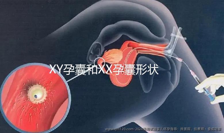 XY孕囊和XX孕囊形狀各有差異,橢圓形可能是懷女哦!