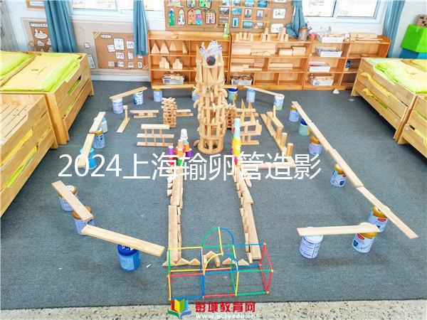 2024上海輸卵管造影檢查多少錢速覽,關(guān)鍵看能否報銷