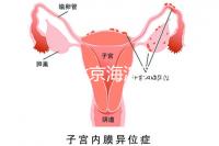 2024年北京海淀區(qū)新生兒醫(yī)療保險處理策略,照片要求不要出錯